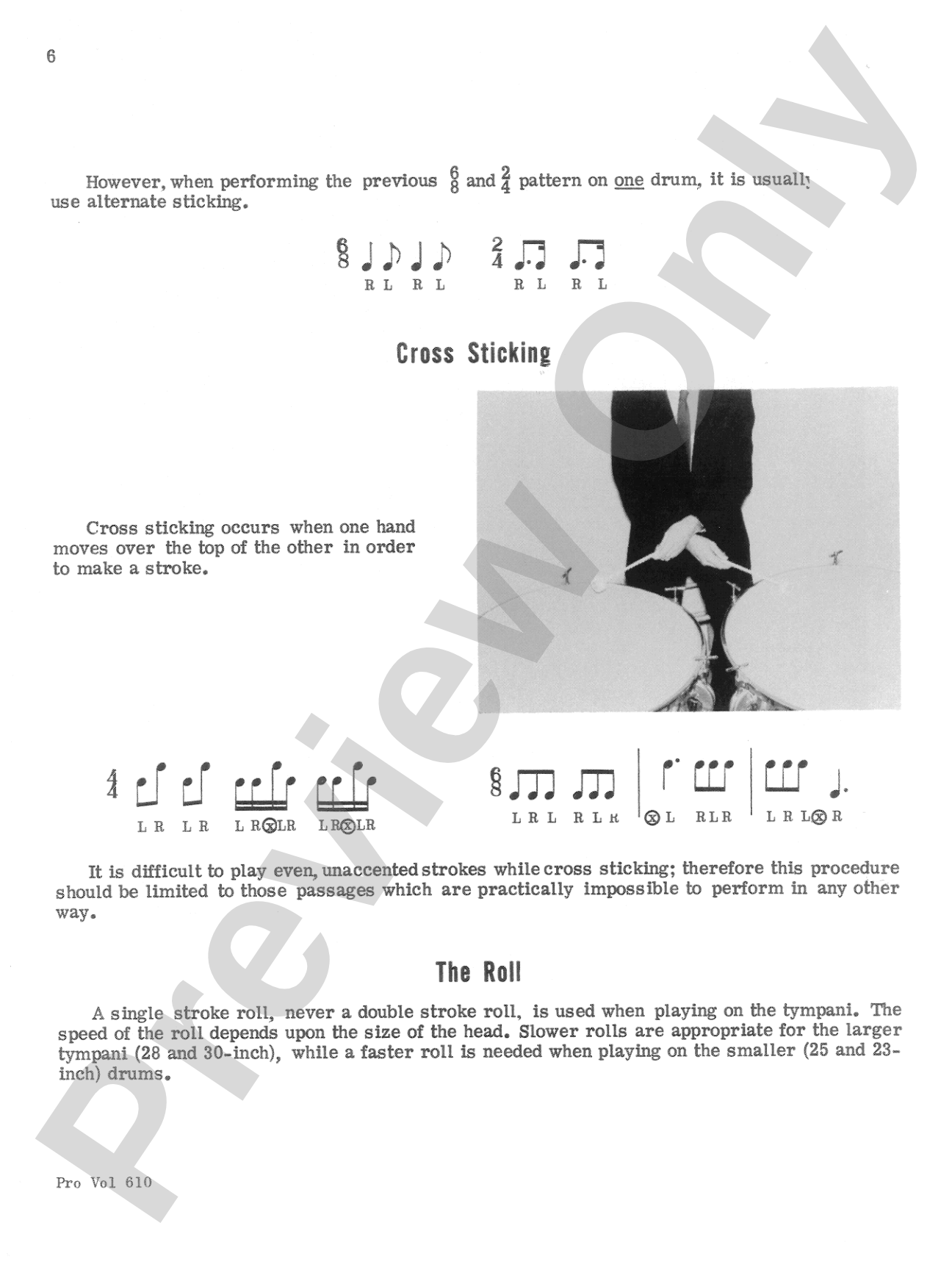 Basic Tympani Technique: A Comprehensive Method for Tympani