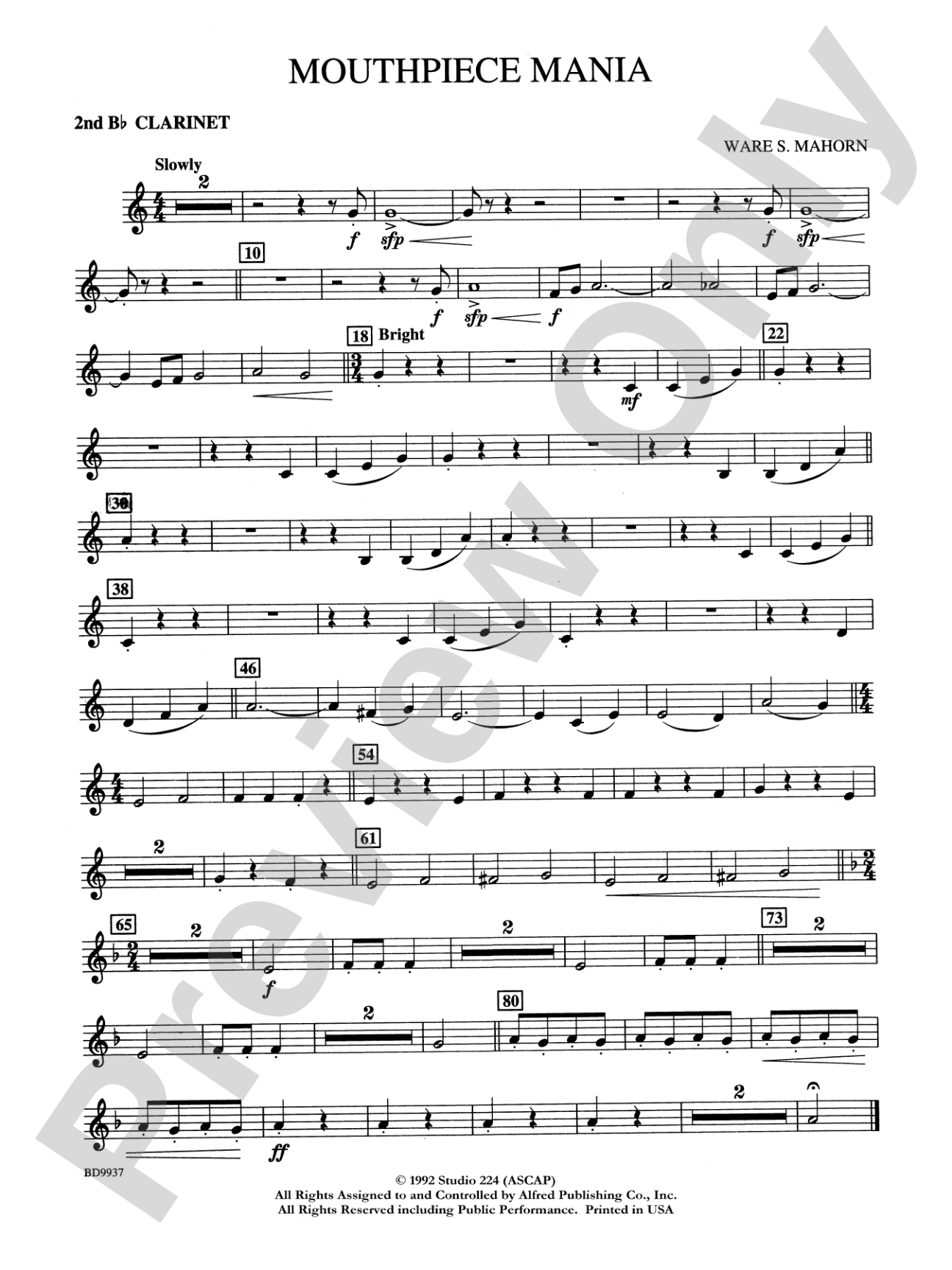 Mouthpiece Mania: 2nd B-flat Clarinet
