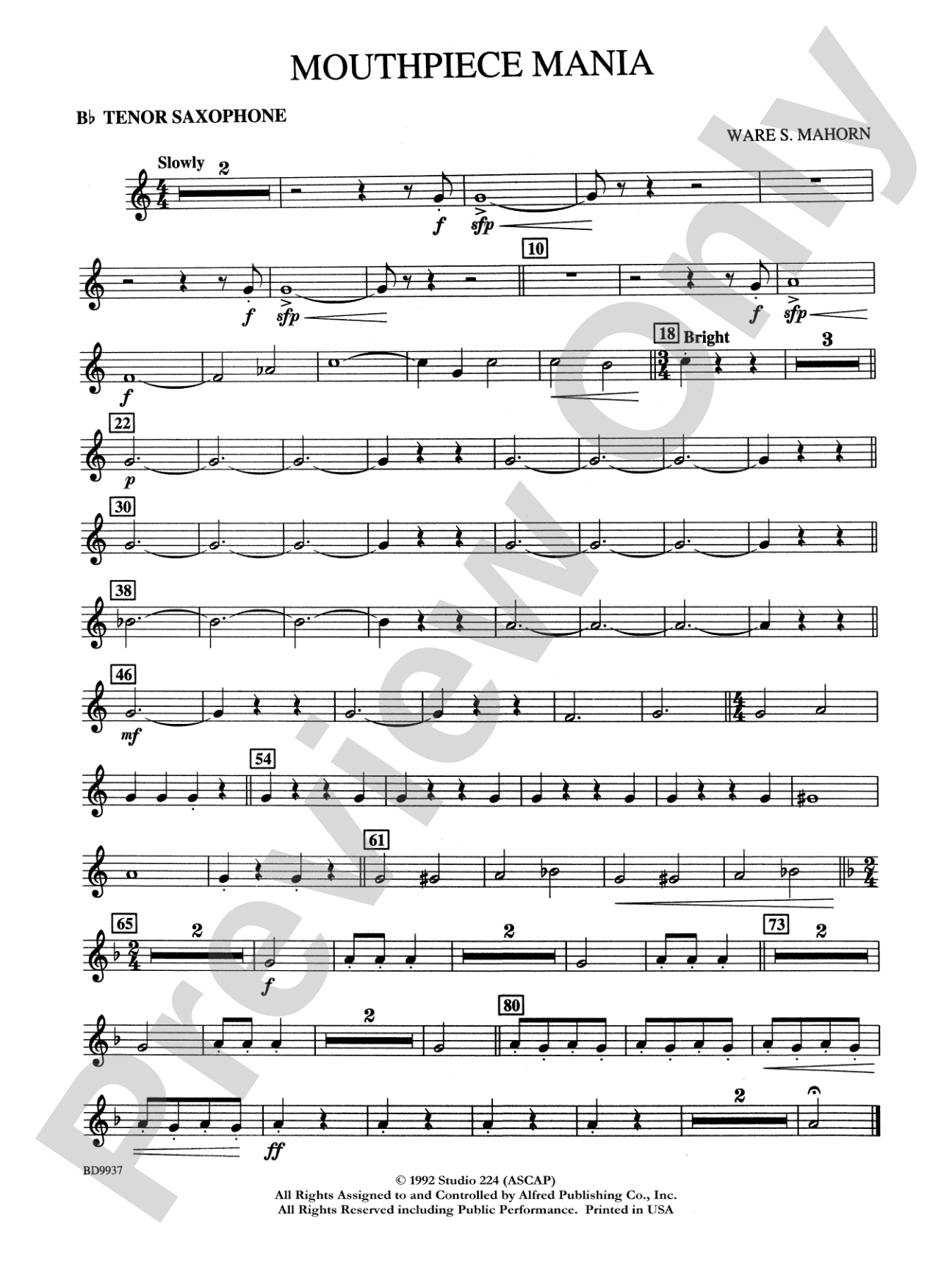 Mouthpiece Mania: B-flat Tenor Saxophone