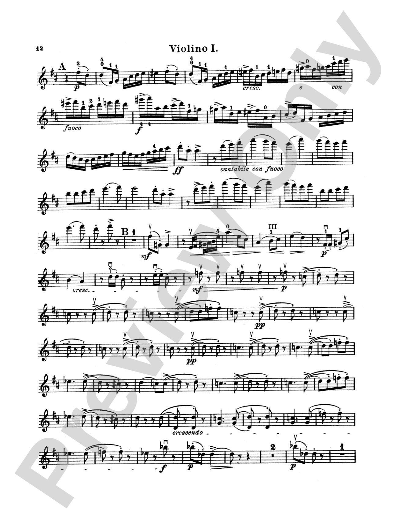 String Quartet in D Major, Op. 11: String Quartet Book