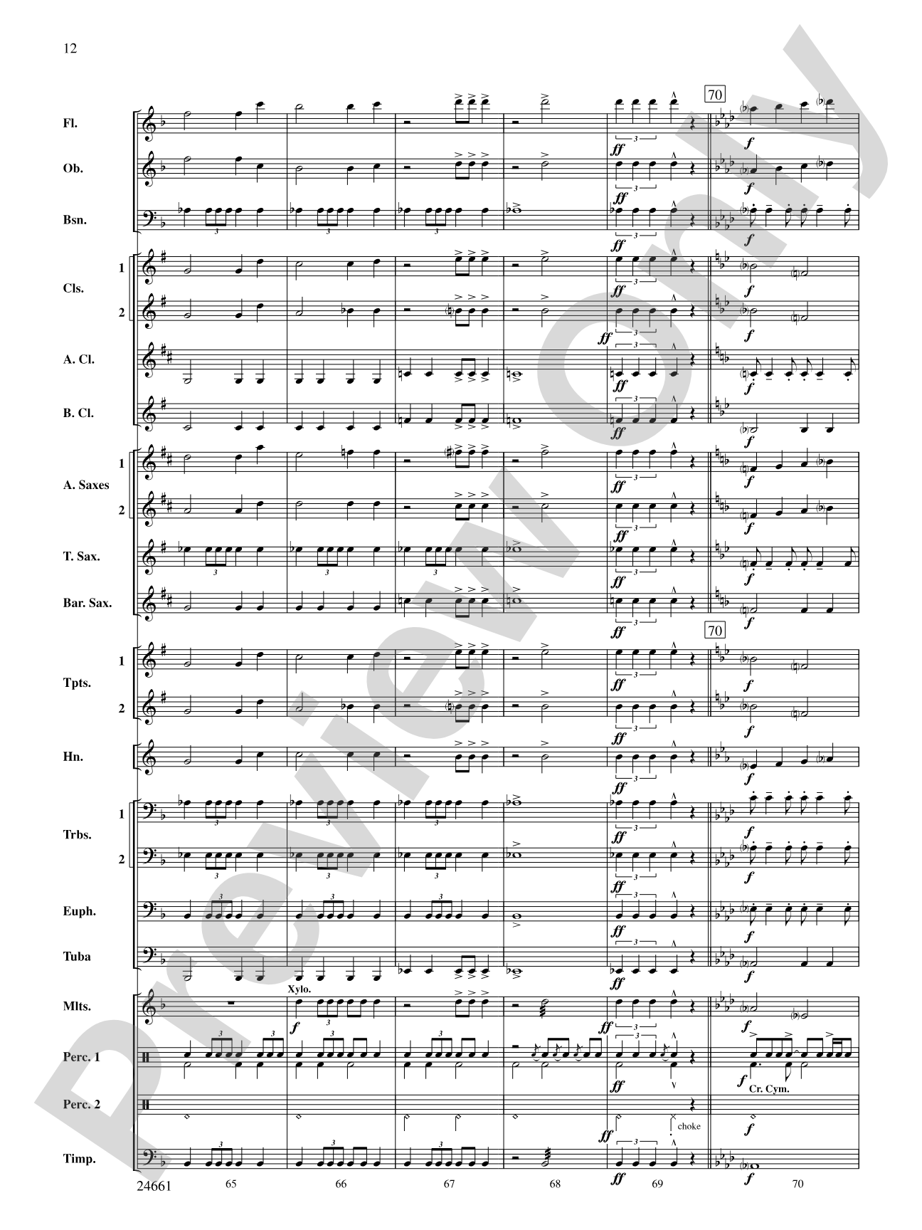 The Legend of Twin Peaks: Score