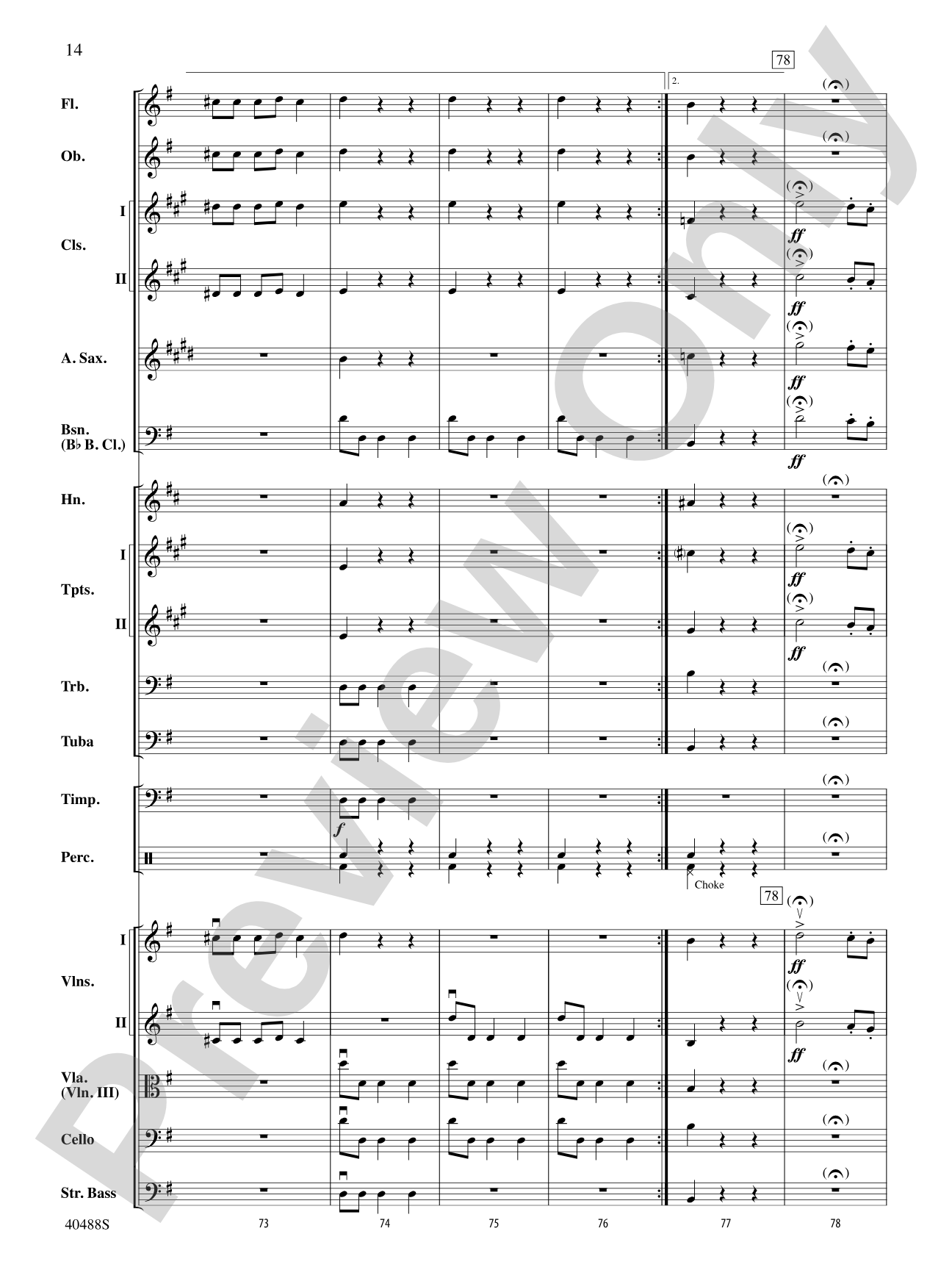 Overture to Die Fledermaus: Full Orchestra Conductor Score & Parts