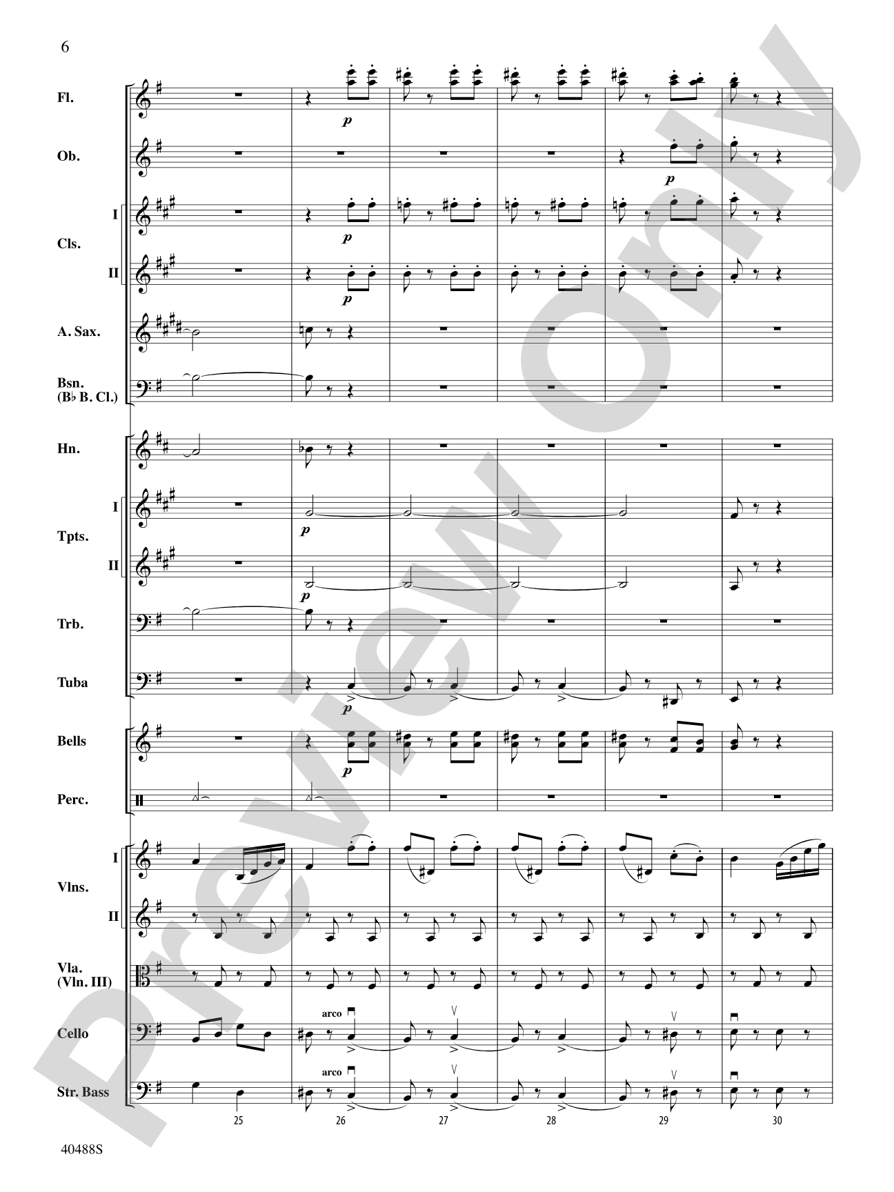 Overture to Die Fledermaus: Full Orchestra Conductor Score & Parts