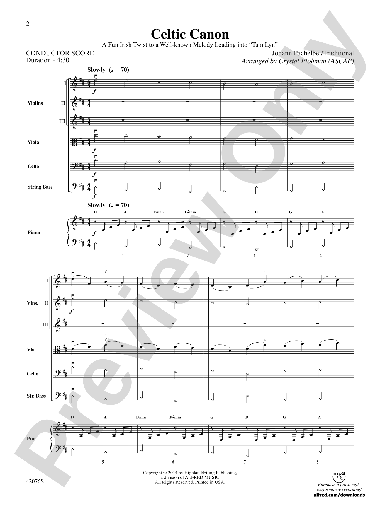 Celtic Canon: String Orchestra Conductor Score & Parts