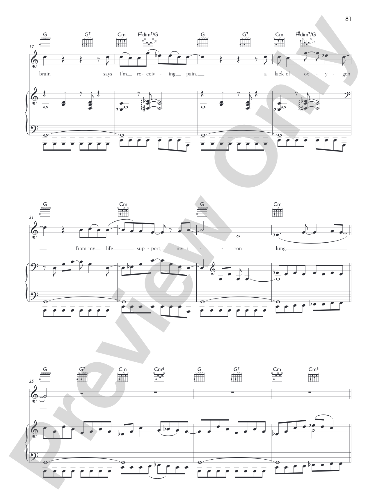 My Iron Lung: Piano/Vocal/Chords